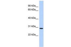SERTAD2 anticorps  (AA 35-84)