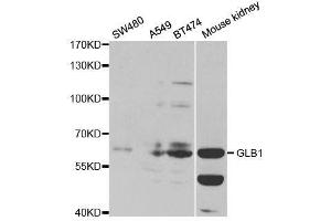 Western blot analysis of extracts of various cell lines, using GLB1 antibody. (GLB1 anticorps  (AA 1-270))