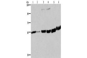 Western Blotting (WB) image for anti-Melanin-Concentrating Hormone Receptor 1 (MCHR1) antibody (ABIN2434978)