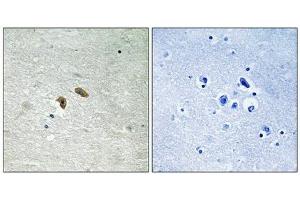 Immunohistochemical analysis of paraffin-embedded human brain tissue using C-RAF (Phospho-Thr269) antibody (left)or the same antibody preincubated with blocking peptide (right). (RAF1 anticorps  (pThr269))