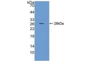 Detection of Recombinant SIRPa, Human using Polyclonal Antibody to Signal Regulatory Protein Alpha (SIRPa)