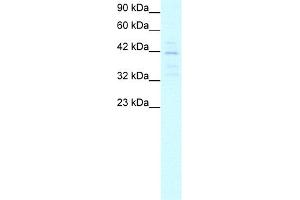 WB Suggested Anti-MORF4L1 Antibody Titration:  5. (MORF4L1 anticorps  (Middle Region))