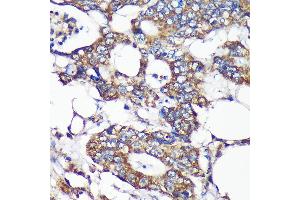 Immunohistochemistry of paraffin-embedded Human colon carcinoma using SLIRP Rabbit pAb (ABIN7270560) at dilution of 1:100 (40x lens). (SLIRP anticorps  (AA 1-100))