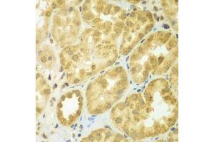 Immunohistochemistry of paraffin-embedded human kidney using ADCK3 antibody (ABIN5975514) at dilution of 1/100 (40x lens). (COQ8A anticorps)