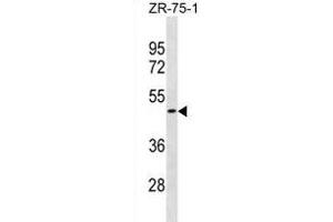 OR1S2 Antibody (C-term) (ABIN1881599 and ABIN2838716) western blot analysis in ZR-75-1 cell line lysates (35 μg/lane). (OR1S2 anticorps  (C-Term))