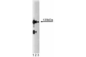 Western blot analysis of CASK on a rat cerebrum lysate. (CASK anticorps  (AA 353-486))