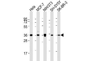 All lanes : Anti-ANXA2 Antibody (N-term) at 1:2000 dilution Lane 1: Hela whole cell lysates Lane 2: MCF-7 whole cell lysates Lane 3: NIH/3T3 whole cell lysates Lane 4: SH-SY5Y whole cell lysates Lane 5: SK-BR-3 whole cell lysates Lysates/proteins at 20 μg per lane.