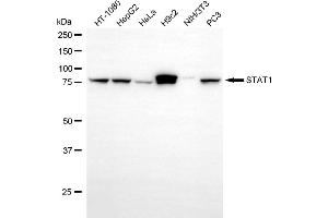 Western blotting analysis using STAT1 antibody (ABIN7800335).