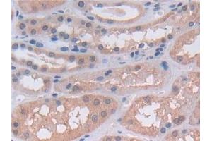 Detection of UTRN in Human Kidney Tissue using Polyclonal Antibody to Utrophin (UTRN)