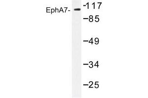 Image no. 1 for anti-EPH Receptor A7 (EPHA7) antibody (ABIN272234) (EPH Receptor A7 anticorps)
