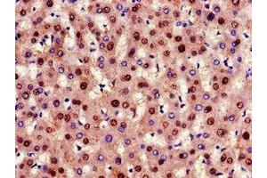 Immunohistochemistry of paraffin-embedded human liver tissue using ABIN7153869 at dilution of 1:100