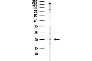anti-ADP-Ribosylation Factor 6 (ARF6) (Internal Region) antibody