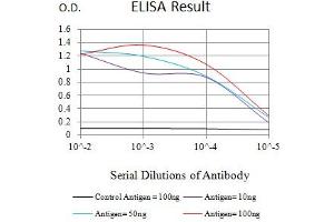 Black line: Control Antigen (100 ng),Purple line: Antigen (10 ng), Blue line: Antigen (50 ng), Red line:Antigen (100 ng)