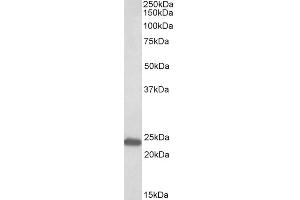 ABIN625812 (0. (GM2A anticorps  (AA 164-175))