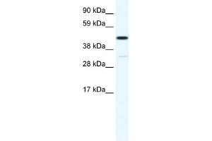 WB Suggested Anti-HOXA3 Antibody Titration:  1. (HOXA3 anticorps  (N-Term))