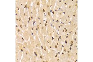 Immunohistochemistry of paraffin-embedded Rat heart using LMNA antibody at dilution of 1:100 (x400 lens).