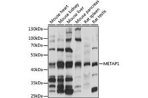 Western blot analysis of extracts of various cell lines, using MET antibody (ABIN7268489) at 1:1000 dilution. (METAP1 anticorps  (AA 177-386))