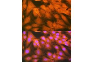 Immunofluorescence analysis of C6 cells using HSP Rabbit mAb (ABIN7267579) at dilution of 1:100 (40x lens).