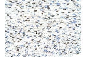 DAZAP1 antibody was used for immunohistochemistry at a concentration of 4-8 ug/ml to stain Myocardial cells (arrows) in Human Heart.