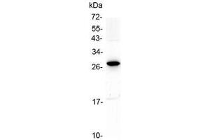 Western blot testing of human placental tissue with IL15RA antibody at 0.