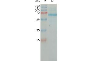 Human PLAT Protein, His Tag on SDS-PAGE under reducing condition.