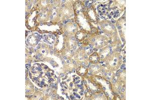 Immunohistochemistry of paraffin-embedded rat kidney using RAB5C antibody.