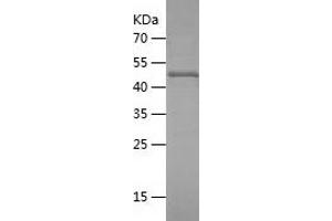Western Blotting (WB) image for Programmed Cell Death 6 Interacting Protein (PDCD6IP) (AA 1-239) protein (His-IF2DI Tag) (ABIN7124578)