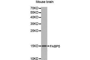 Western Blotting (WB) image for anti-Fatty Acid Binding Protein 5 (Psoriasis-Associated) (FABP5) (AA 1-100) antibody (ABIN1679794) (FABP5 anticorps  (AA 1-100))