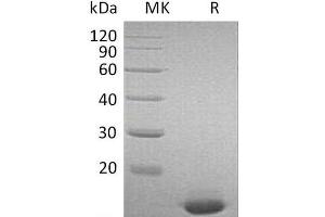 Western Blotting (WB) image for Interferon, alpha 2 (IFNA2) protein (ABIN7320562) (IFNA2 Protéine)