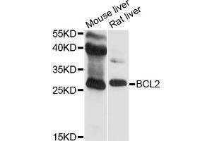 Western blot analysis of extracts of various cell lines, using BCL2 antibody. (Bcl-2 anticorps)