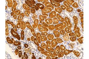 anti-Immediate Early Response 3 (IER3) (C-Term) antibody