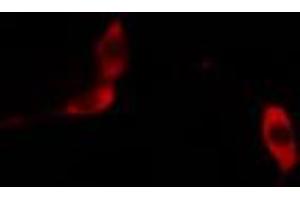 ABIN6268655 staining PC-3 cells by IF/ICC. (Insulin anticorps)