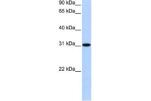 TNRC18 antibody used at 0. (TNRC18 anticorps  (N-Term))