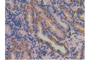 IHC-P analysis of Human Stomach Tissue, with DAB staining. (SERPINA7 anticorps  (AA 128-415))