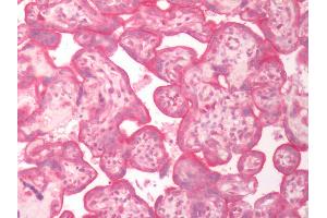 Human Placenta: Formalin-Fixed, Paraffin-Embedded (FFPE) (SLC5A6 anticorps  (Internal Region))