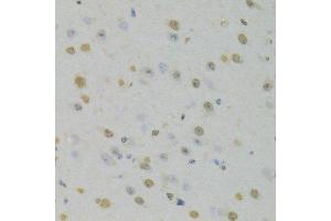 Immunohistochemistry of paraffin-embedded mouse brain using HNRNPD Antibody.