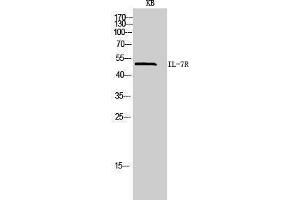 Western Blotting (WB) image for anti-Interleukin 7 Receptor (IL7R) (Internal Region) antibody (ABIN3181445) (IL7R anticorps  (Internal Region))