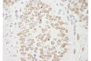 Immunohistochemistry (IHC) image for anti-Protein Arginine Methyltransferase 6 (PRMT6) (C-Term) antibody (ABIN7448744) (PRMT6 anticorps  (C-Term))