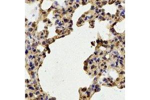 Immunohistochemistry (IHC) image for anti-Stress-Induced-phosphoprotein 1 (STIP1) antibody (ABIN7308382)