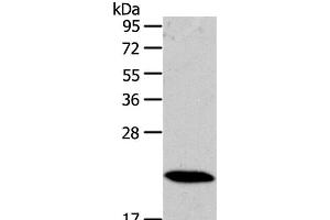 Western Blot analysis of Mouse heart tissue using RAB18 Polyclonal Antibody at dilution of 1:400