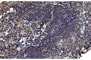 IHC analysis of OTULIN using anti-OTULIN antibody (ABIN7601854). (FAM105B anticorps  (AA 49-352))
