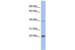 Image no. 1 for anti-Proteasome Subunit alpha 4 (PSMA4) (AA 35-84) antibody (ABIN6743269) (PSMA4 anticorps  (AA 35-84))