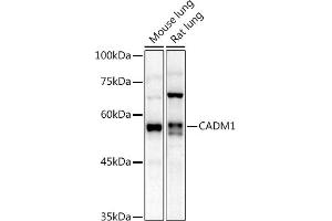 Western blot analysis of extracts of various cell lines, using C antibody (ABIN3022654, ABIN3022655, ABIN3022656 and ABIN6219028) at 1:1000 dilution. (CADM1 anticorps  (AA 45-344))