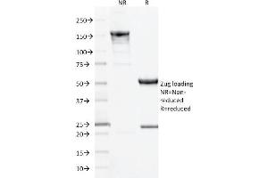 SDS-PAGE Analysis Purified CD10 Mouse Monoclonal Antibody (MME/1893). (MME anticorps  (AA 297-483))