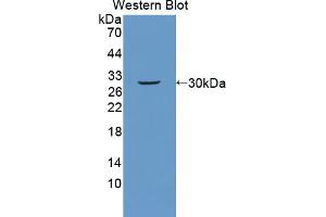 Western blot analysis of the recombinant protein. (PLXNB1 anticorps  (AA 1598-1849))