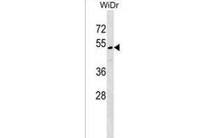 MLF1IP Antibody (C-term) (ABIN1537070 and ABIN2849045) western blot analysis in WiDr cell line lysates (35 μg/lane). (MLF1IP anticorps  (C-Term))