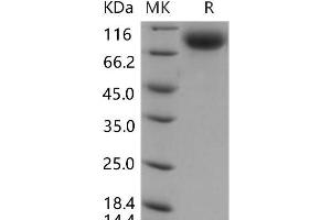 Western Blotting (WB) image for Selectin E (SELE) (Active) protein (His tag) (ABIN7197870) (Selectin E/CD62e Protein (His tag))