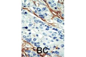Immunohistochemistry (IHC) image for anti-NUAK Family, SNF1-Like Kinase, 1 (NUAK1) antibody (ABIN2908464) (NUAK1 anticorps)