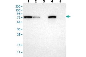 Western blot analysis of Lane 1: RT-4, Lane 2: U-251 MG, Lane 3: Human Plasma, Lane 4: Liver, Lane 5: Tonsil with HADHA polyclonal antibody  at 1:250-1:500 dilution. (HADHA anticorps)