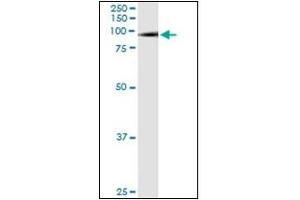 Western Blotting (WB) image for anti-SMAD Specific E3 Ubiquitin Protein Ligase 1 (SMURF1) antibody (ABIN781919)
